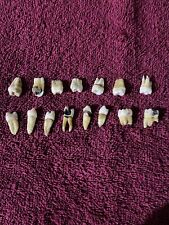 15 Human Teeth Extracted for Research and Dental Studies Molars Premolars picture