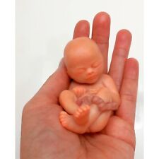 14 Weeks Baby Fetus, Stage of Fetal Development (Memorial/Miscarriage/Keepsake) picture