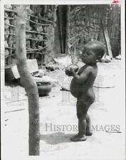 1966 Press Photo African Child with Malnutrition - hpa43335 picture