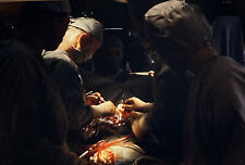 Vintage Photo Slide 1966 Surgery Drs Surgeons Operation Patient picture