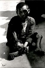 LV98 Original Photo DISABLED MAN BEGS IN STREET Deformities Cigarettes Homeless picture