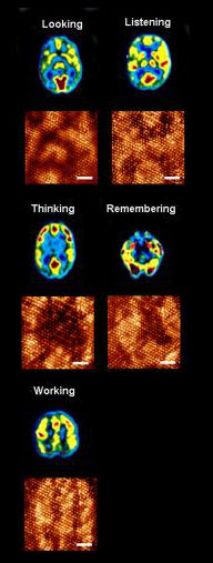 Magnetic resonance images of human brain during different functions appear on top. Similar evolving patterns have been generated on the molecular monolayer one after another (bottom). A snapshot of the evolving pattern for a particular brain function is captured using Scanning Tunneling Microscope at 0.68 V tip bias (scale bar is 6 nm). The input pattern to mimic particular brain function is distinct, and the dynamics of pattern evolution is also typical for a particular brain operation.