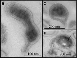 Transmission electron micrograph (TEM) images like these show that most have protrusions (B), dark areas that probably are packed ribosomes (C) and unidentified dark inclusions (D). 