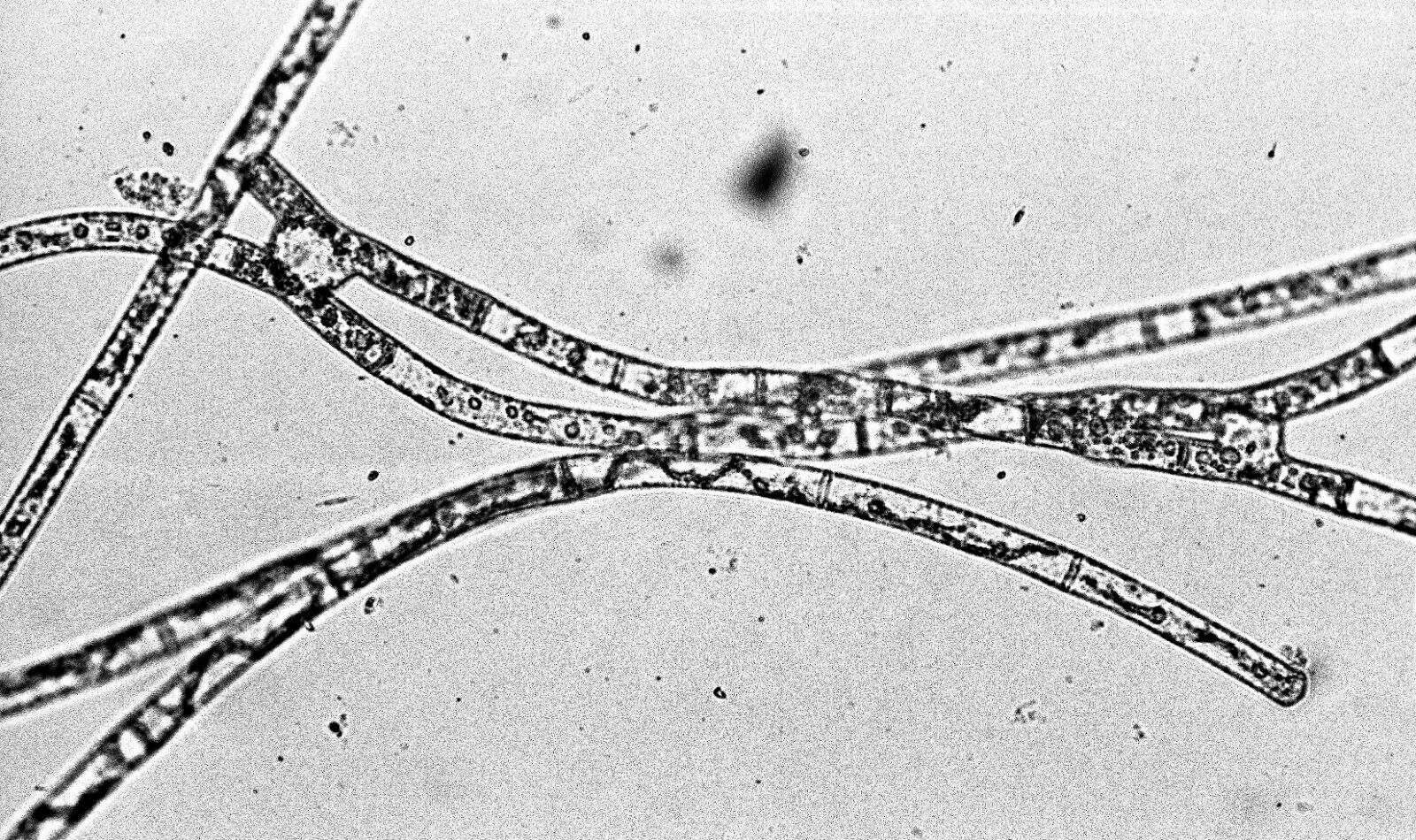 Aquatic Microbes Twelve (12) Original 35 mm Black & White Negatives Algae Diatom