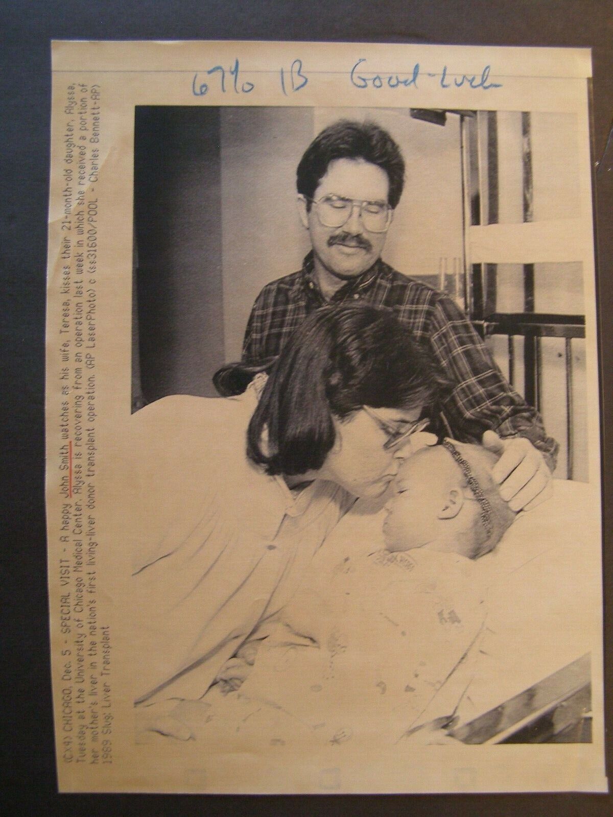 AP Wire Press Photo 1989 First Living Liver transplant Alyssa Smith 21 months 