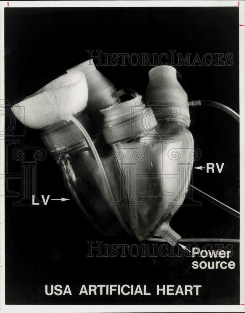 1975 Press Photo Artificial Heart from U.S.A. - hpa44726