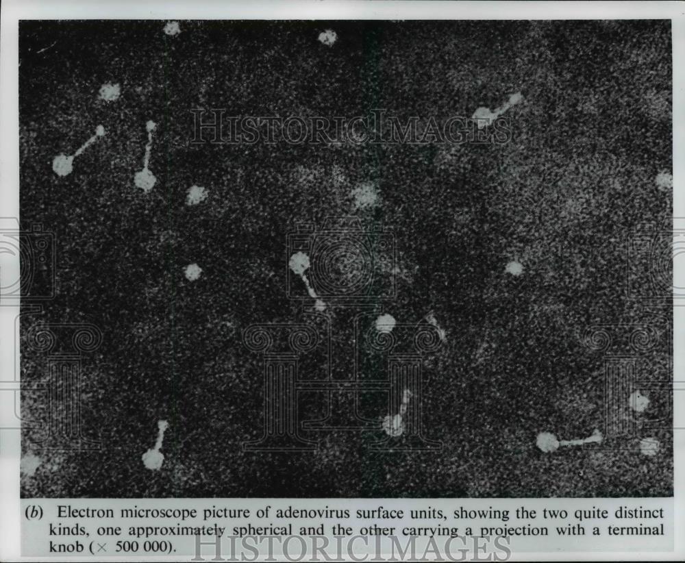 1970 Press Photo Electron microscope picture of adenovirus surface units