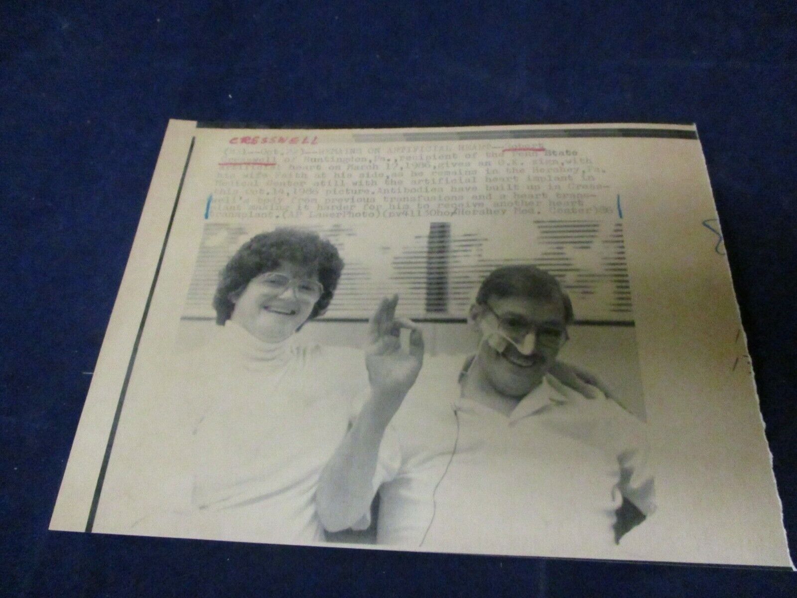 1986 Robert Cresswell PSU artificial heart recipient Hershey PA Wire Press Photo