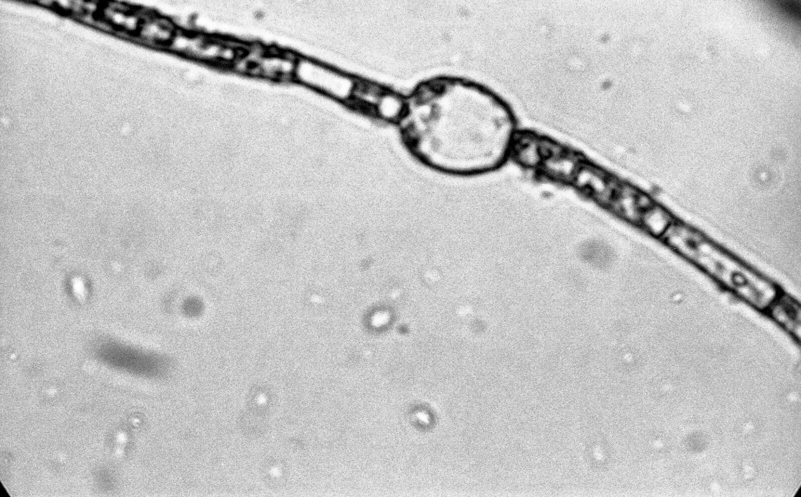Aquatic Microbes Cyanobacteria Ten Original 35 mm Black & White Negatives of
