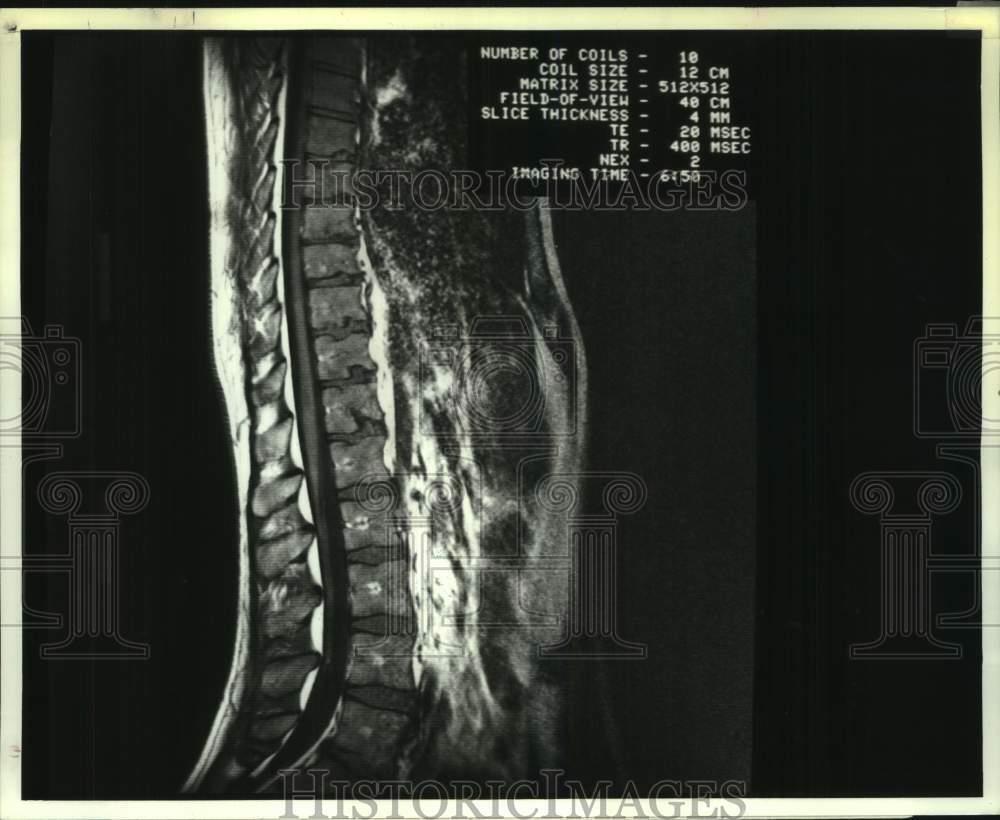 1991 Press Photo Image from a Magnetic Resonance Imaging (MRI) machine, New York