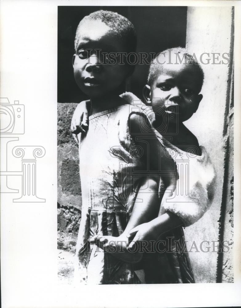 1968 Press Photo Biafran Children dealing with Starvation and Malnutrition