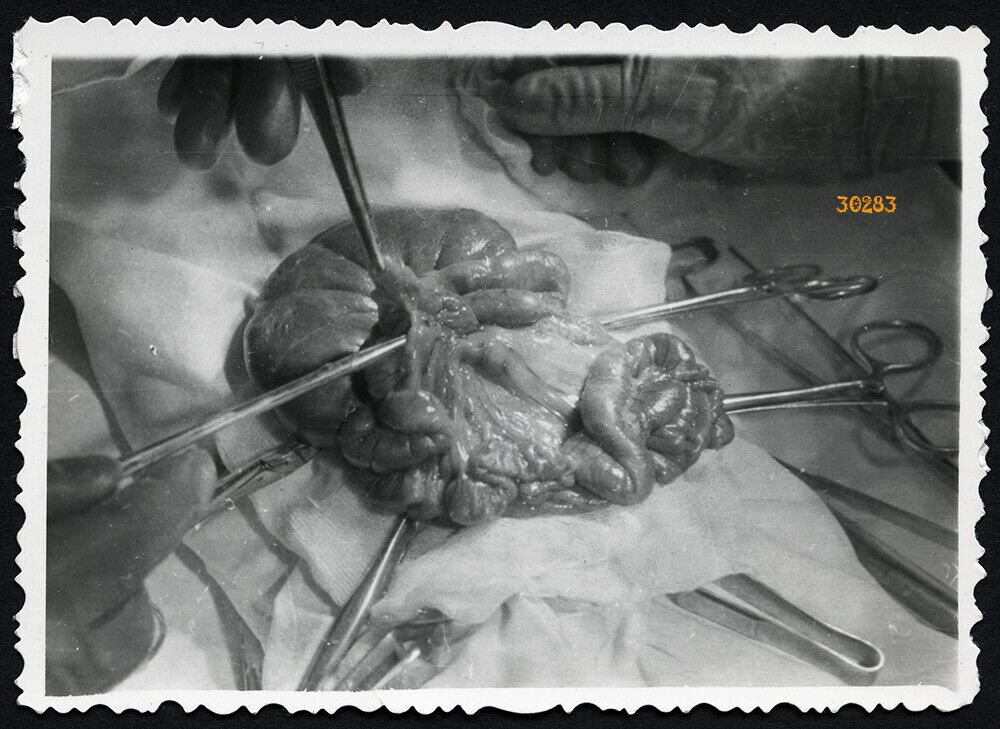 in hospital, surgery, abstract, unusual,  Vintage fine art Photograph, 1940's  