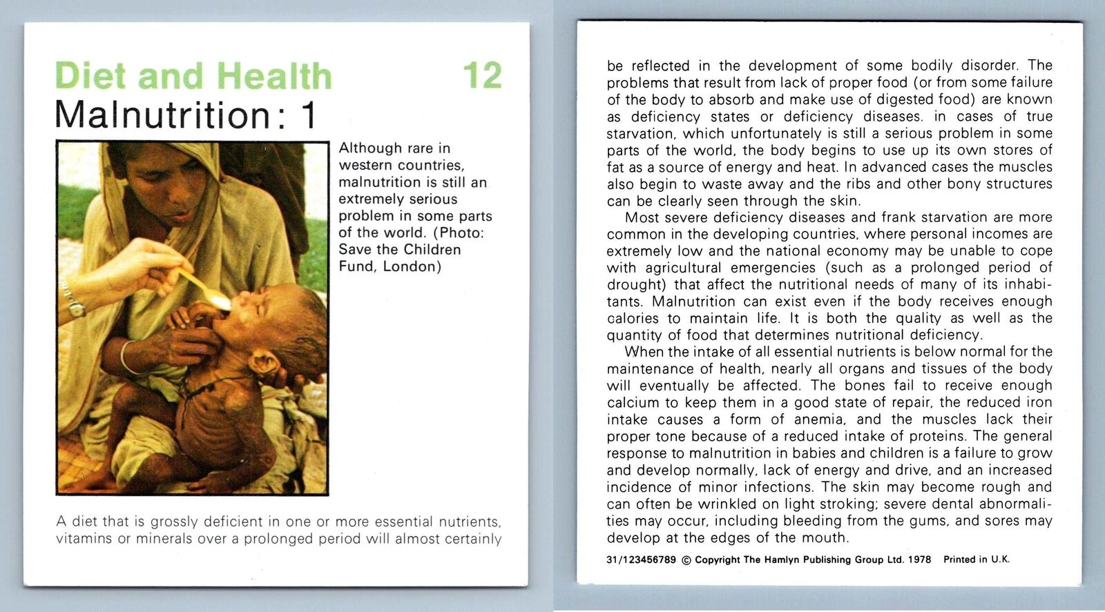 Malnutrition #12 Diet & Health - Home Medical Guide 1975-8 Hamlyn Card