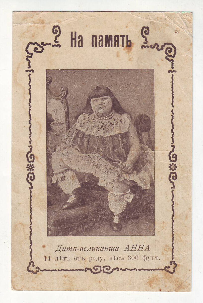 ca1910 Russian Giant Child ANNA 14 years old dawns 300 pounds obesity fat adipos