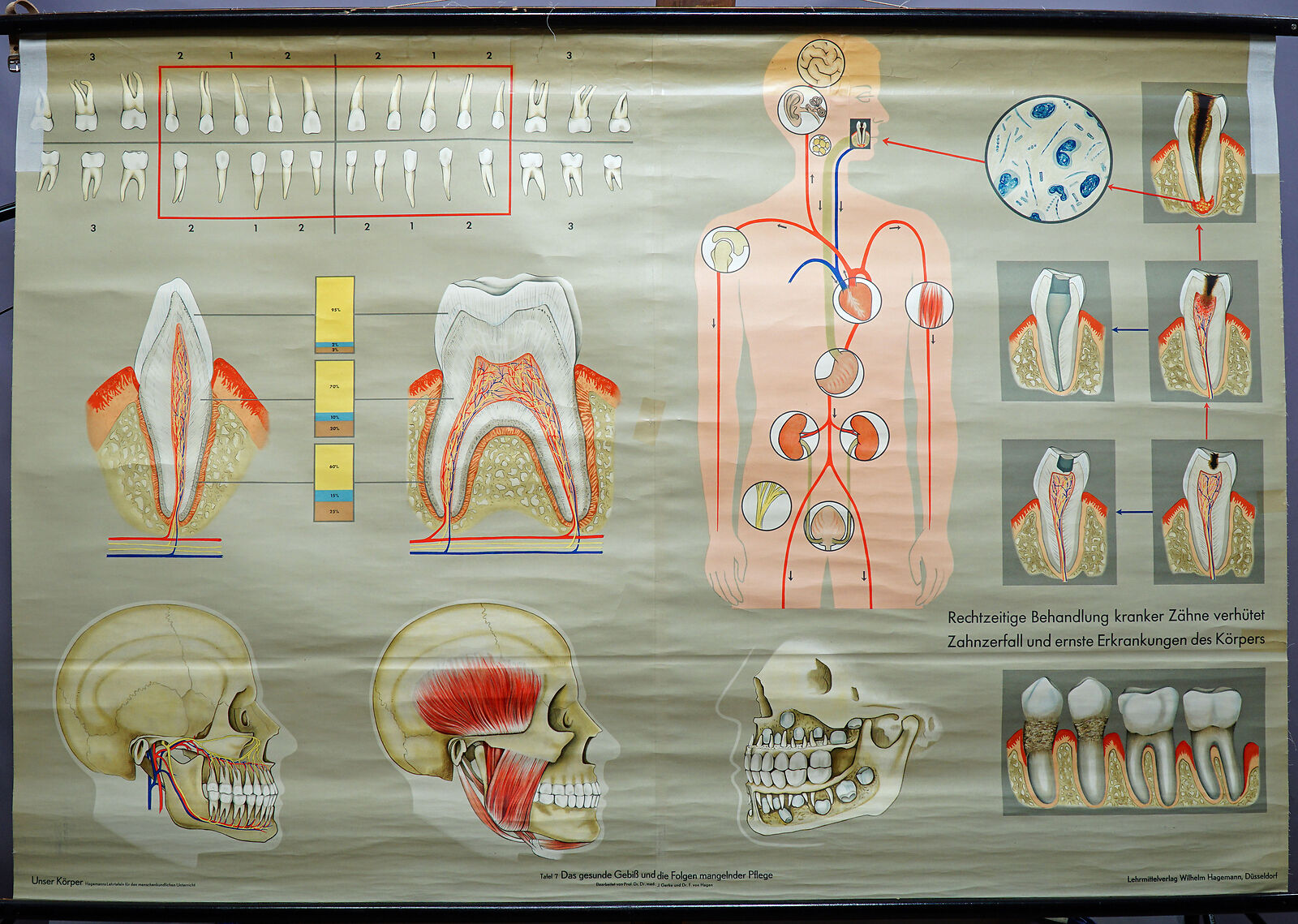 human teeth medical poster vintage rollable wallchart