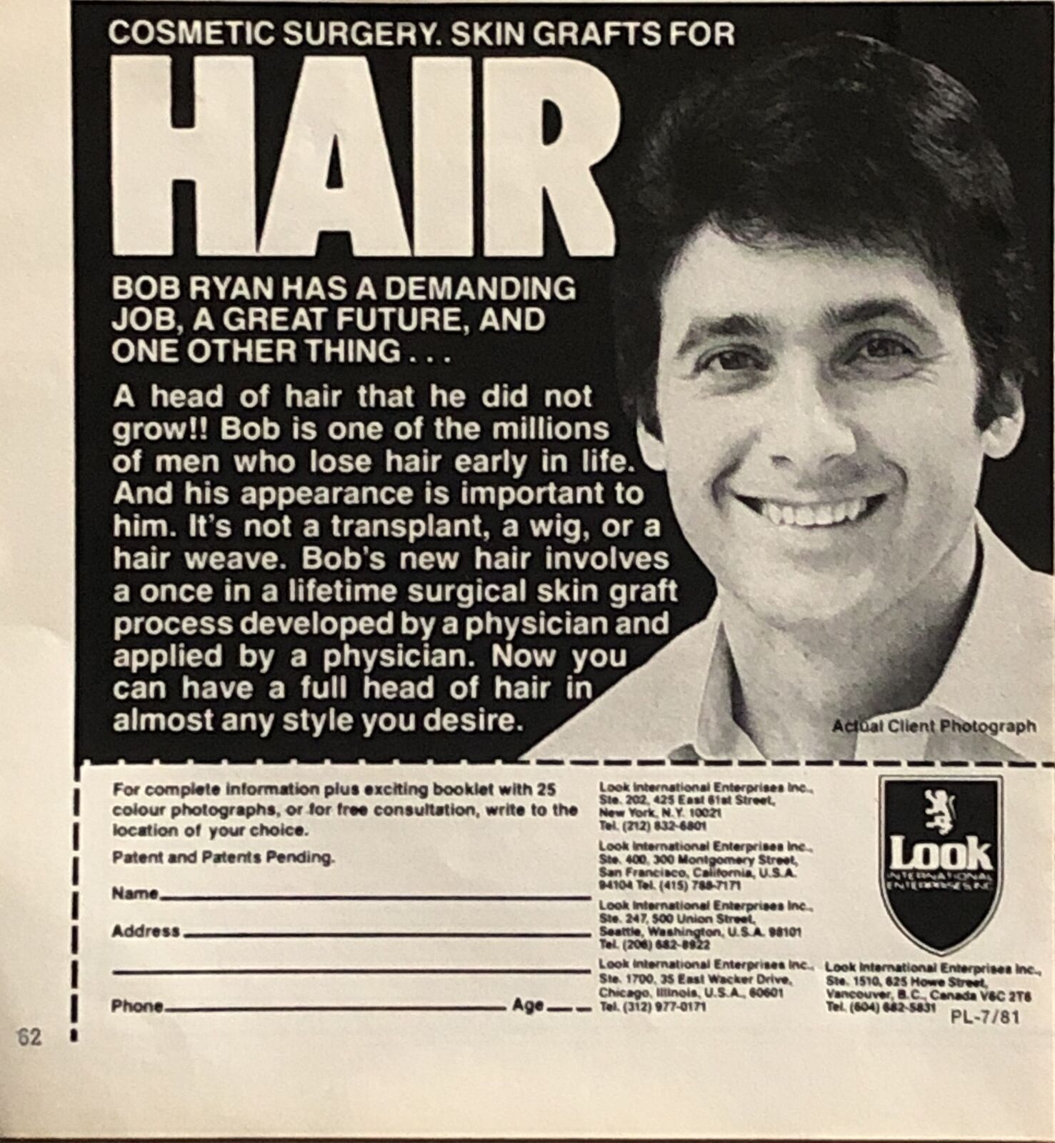 1981 Look International Hair Grafts VTG 1980s PRINT AD Cosmetic Surgery 5.5x5.5