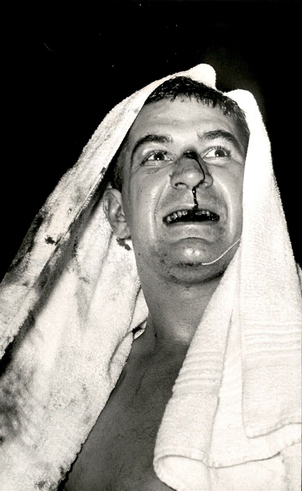 LG925 1966 Original Wm Seaman Photo ED HURLEY Beaten Boxer Bloody Nose Smile