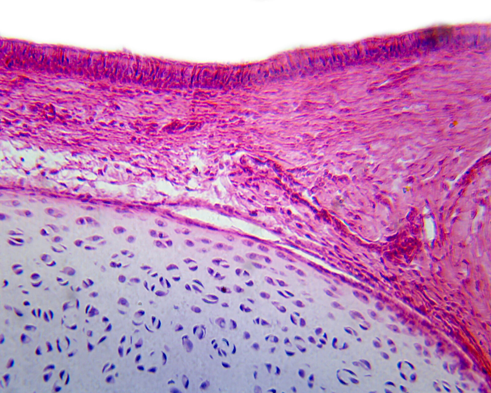 Ciliated Pseudostratified Columnar Epithelium from Respiratory Tissue,