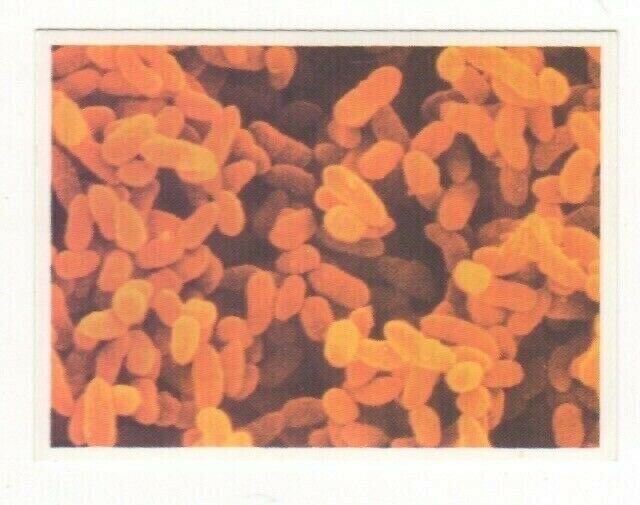 Sanitarium Weet-bix #03 Bacteria as seen under an electron microscope
