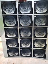 Lot 3 Vtg Medical X-Ray MRI Scans Film Sheets Doctor Display picture
