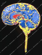 ( cool computer enhanced brain pic Learning Channel documentary TV Understanding picture