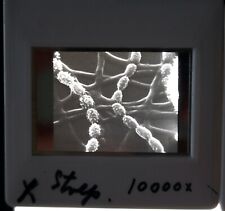 Lot of 11 Vintage Microscope Photo Slides: Strep Bacteria Microscopic Images Art picture