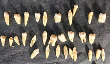 RARE Antique HUMAN TEETH w/ROOTS i-Tooth/ Molar/ Bicuspids 25 Remain picture