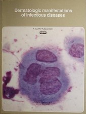 Dermatologic manifestations of infectious diseases (A Scope publication)  picture