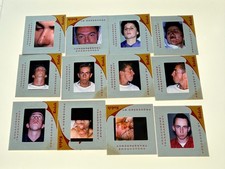 12 COSMETIC SURGERY MEDICAL SLIDES WEIRD STRANGE VINTAGE COLOR 1960s picture