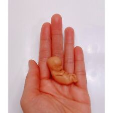 11 Weeks Baby Fetus, Stage of Fetal Development (Memorial/Miscarriage/Keepsake) picture