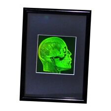 Brain/Skull 3D Photopoloymer Realistic 2-Channel 3D Hologram Picture - Framed picture