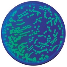 Transformation of E. coli with Green Fluorescent Protein (GFP) picture