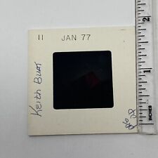 Vintage Photo Slide 1977 Nose Surgery Stitches Medical Graphic picture
