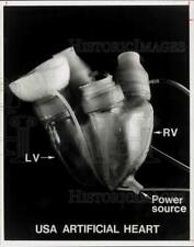 1975 Press Photo Artificial Heart from U.S.A. - hpa44726 picture