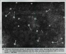 1970 Press Photo Electron microscope picture of adenovirus surface units picture