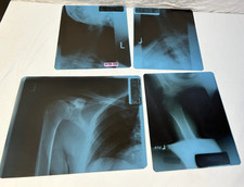 4 Real MRI M R I Film Physical Scan Image  Medical X-ray* picture