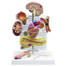 DiabetesType II Organ Model Set GPI Anatomy LFA#4010 Make Us an Offer SEE VIDEO picture