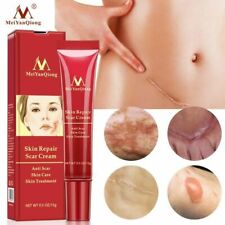 Remove Scar Cream Repair Burn Skin Desalination Surgical Scar Effectively picture