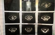 Vintage Radiology X-Ray Photo Sheet picture