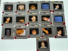 16 METAL COSMETIC SURGERY MEDICAL WEIRD STRANGE  VINTAGE COLOR SLIDES picture