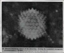 1970 Press Photo Electron microscope picture of the adenovirus - cvb57541 picture