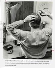 Press Photo Man Using Rogaine Topical Solution on Scalp for Hair Regrowth picture