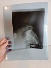 Vintage Radiology X-Ray Picture Sheet 1980s Skull Base 1987 14