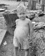 Sharecropper's Child Suffering from Rickets and Malnutrition 8x10 Photo Reprint picture