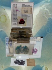 Neuroanatomy Neuropathology Microscope Slide Set Brain CNS Ocular Special Senses picture