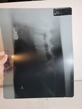Vintage Radiology X-Ray Picture Sheet 1980s Spine 1987 14