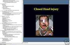 TRAUMATIC BRAIN INJURY TBI Clinical Mgt. PowerPoint Presentation on CD picture