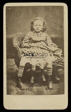 Rare / Unusual Photo 4-Legged Girl with Parasitic Twin / Sideshow Freak Show picture