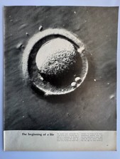 Image The Beginning Of Life Human Egg Enlarged 825 Times picture
