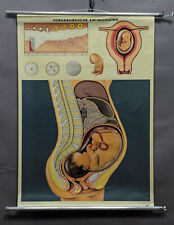 vintage poster wall chart gynecology waiting room prenatal development baby picture